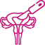 cancers-gynecologique